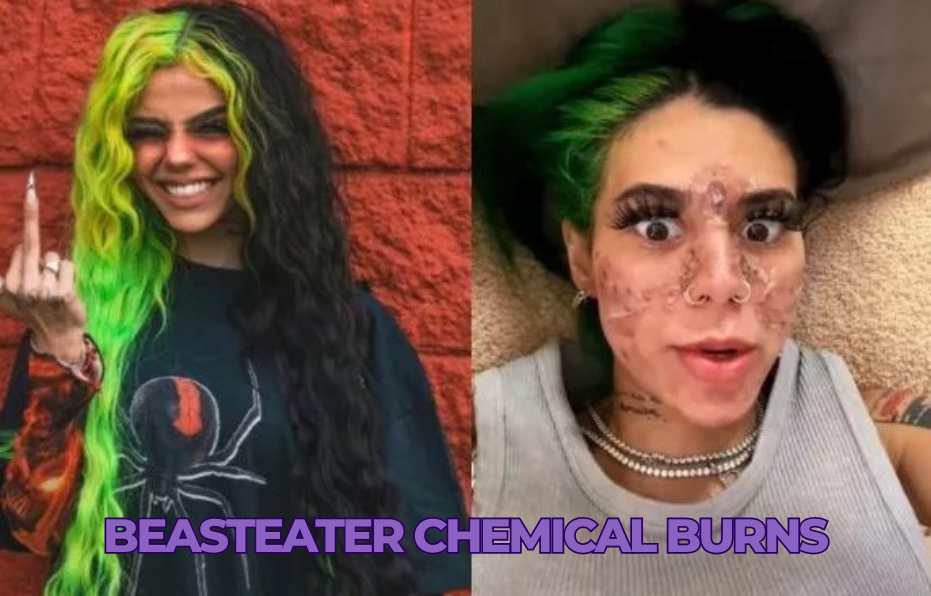 beasteater chemical burns